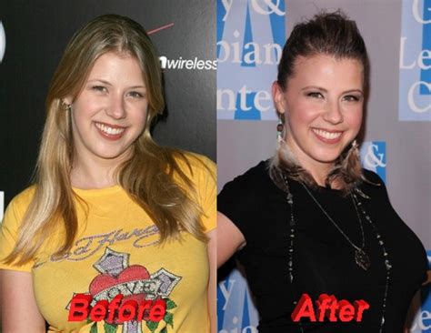 Jodie Sweetin Plastic Surgery: Uncovering the Truth